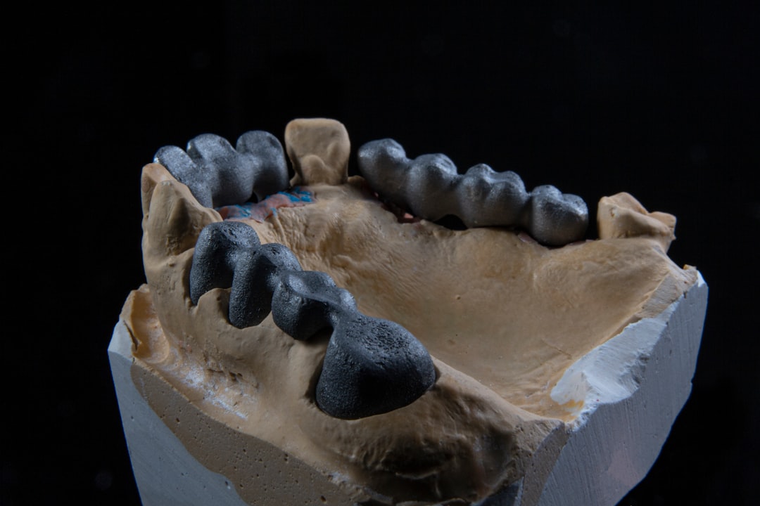 Het menselijk gebit: hoeveel kiezen heeft een mens?